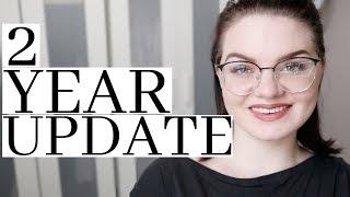 TRUSMILE VENEERS 2 YEAR UPDATE | JADELUX